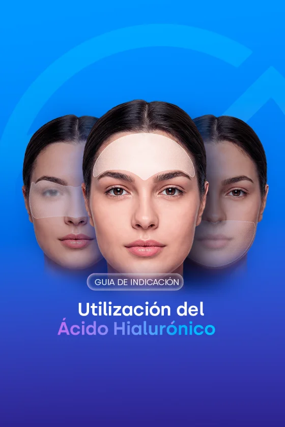 Guía de indicaciones del ácido hialurónico